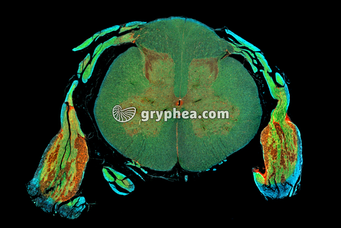 Moëlle épinière avec ganglions CT x2 - gryphea.com